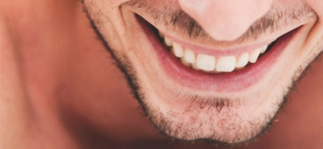 Clear Braces For Adults | Clear Braces In Fresno CA