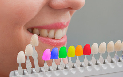 Things Might Happen After The Tooth Colored Fillings | Fresno Dentist Teeth