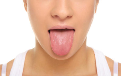 Sore or painful tongue  | Dentist in Fresno CA