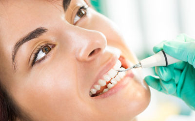 How Often Should I Go to the Dentist for a Teeth Cleaning? | Dentist in Fresno CA