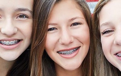 What is the best age for braces? | Dentist in Fresno CA