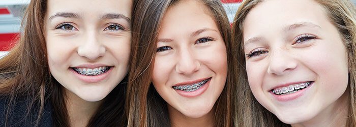 What is the best age for braces? | Dentist in Fresno CA