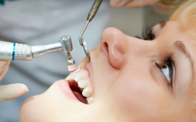 4 Reasons To Schedule A Dental Cleaning Today| Dentist in Fresno CA